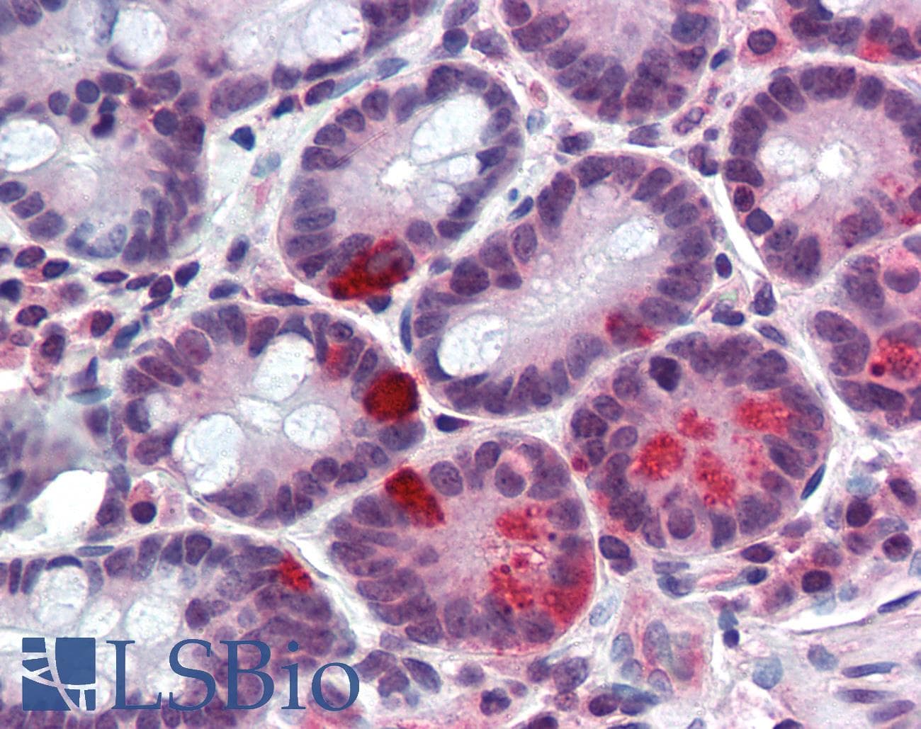 PAX4 Antibody (aa166-215, HRP)