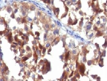 CD63 Antibody (clone CDLA63-1)