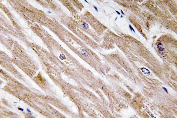 BMP5 Antibody (aa114-163)