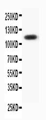 PR / Progesterone Receptor Antibody (aa536-553)