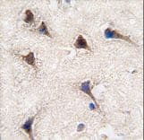 SEMA6A / Semaphorin 6A Antibody (aa998-1028)