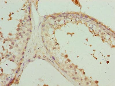 PHF13 Antibody