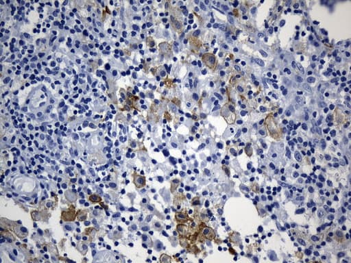 MSR1 / CD204 Antibody (aa197-451, clone UMAB247, Carrier-free)