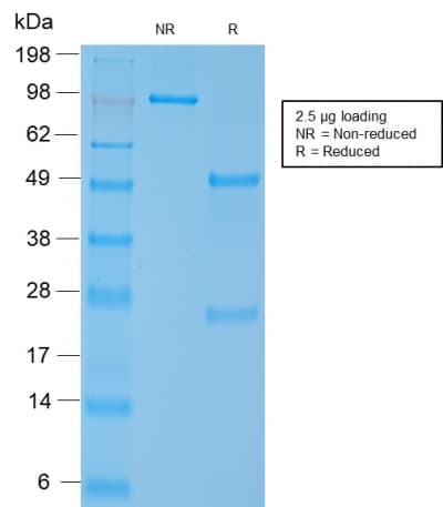 PathPlus™ SMMHC / MYH11 Antibody (clone MYH11/2303R)