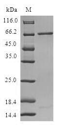 Human RP2 Protein (Recombinant GST, N-terminus)