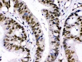 XPO1 / CRM1 Antibody
