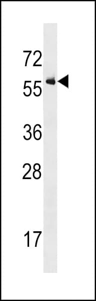 Polyclonal Rabbit anti-Human ALK2 / ACVR1 Antibody (aa132-162, IHC, WB)