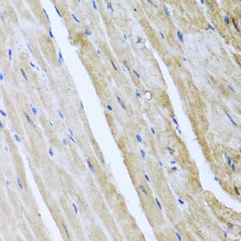 CAMK2G / CaMK II Gamma Antibody