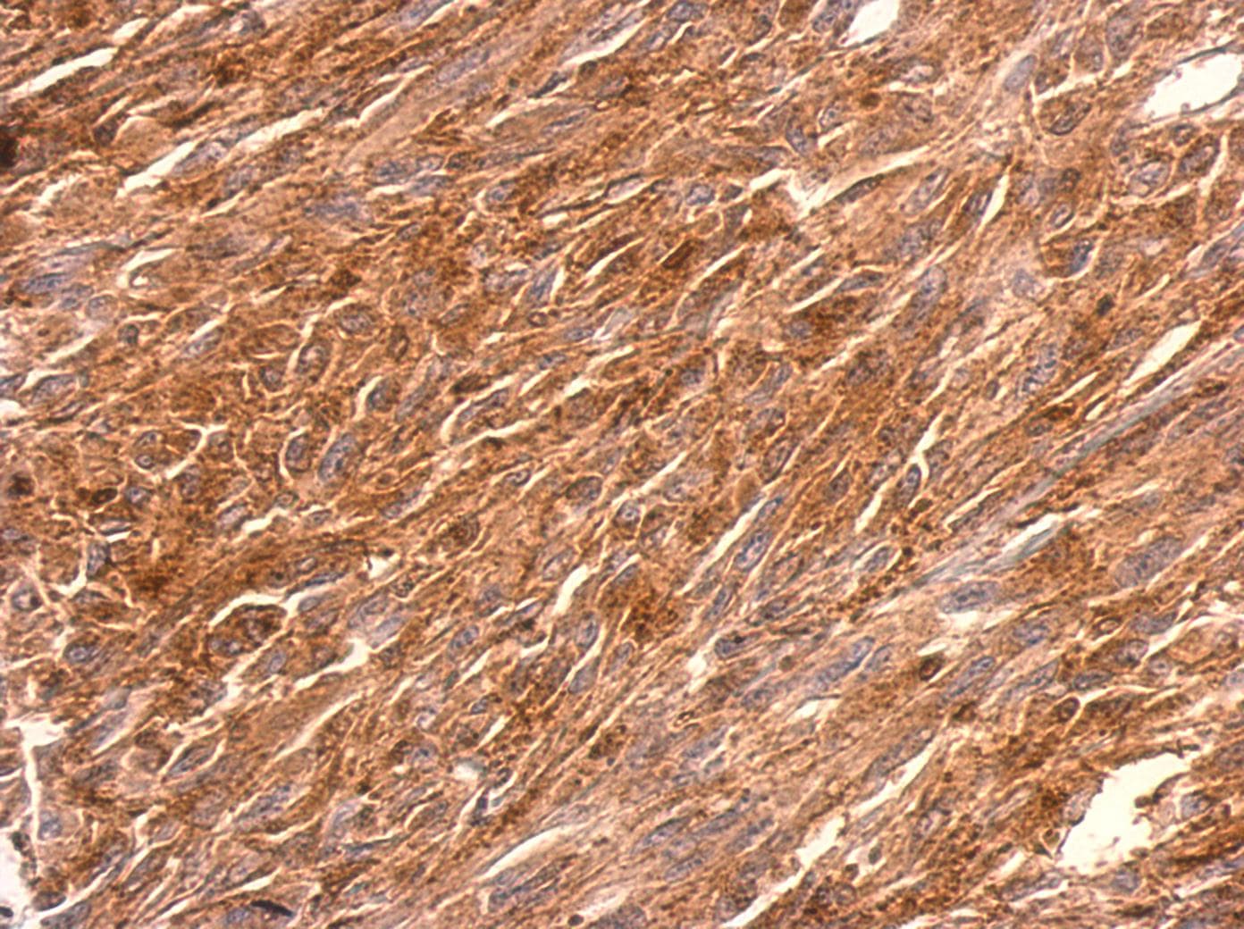 Polyclonal Rabbit anti-Human PGCP / Aminopeptidase Antibody (aa19-296, IHC, WB)