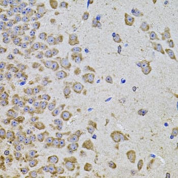 PIK3CA / PI3K Alpha Antibody