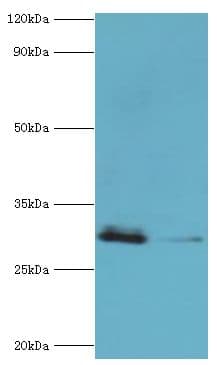 Polyclonal Rabbit anti-Human CBR3 Antibody (aa118-277, IHC, WB)