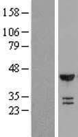 PSMC4 Protein (Over-Expression Lysate Myc-DDK (Flag))
