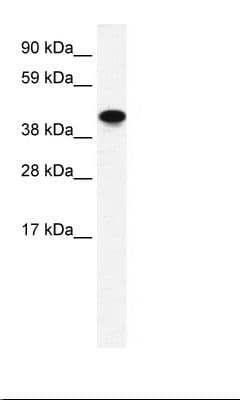 PathPlus™ Polyclonal Rabbit anti-Human ENO1 / Alpha Enolase Antibody (aa246-295, IHC, WB)