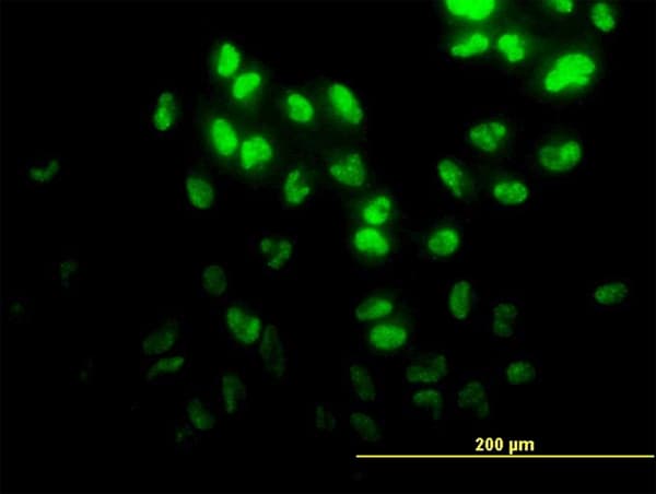 DPH2 Antibody (clone 5B10)