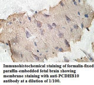 PCDHB10 Antibody (aa27-692)