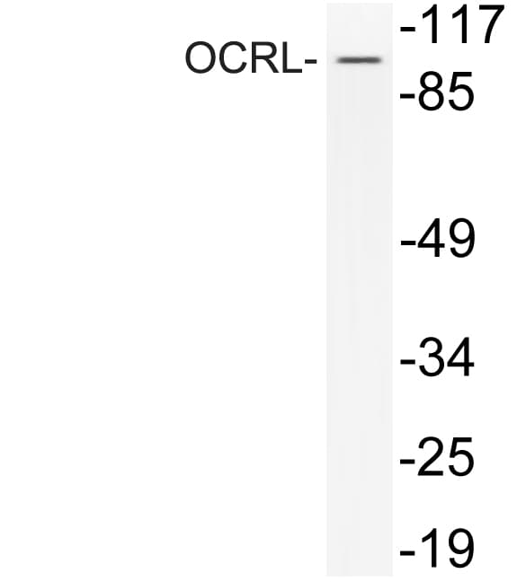 OCRL Antibody (aa150-199)