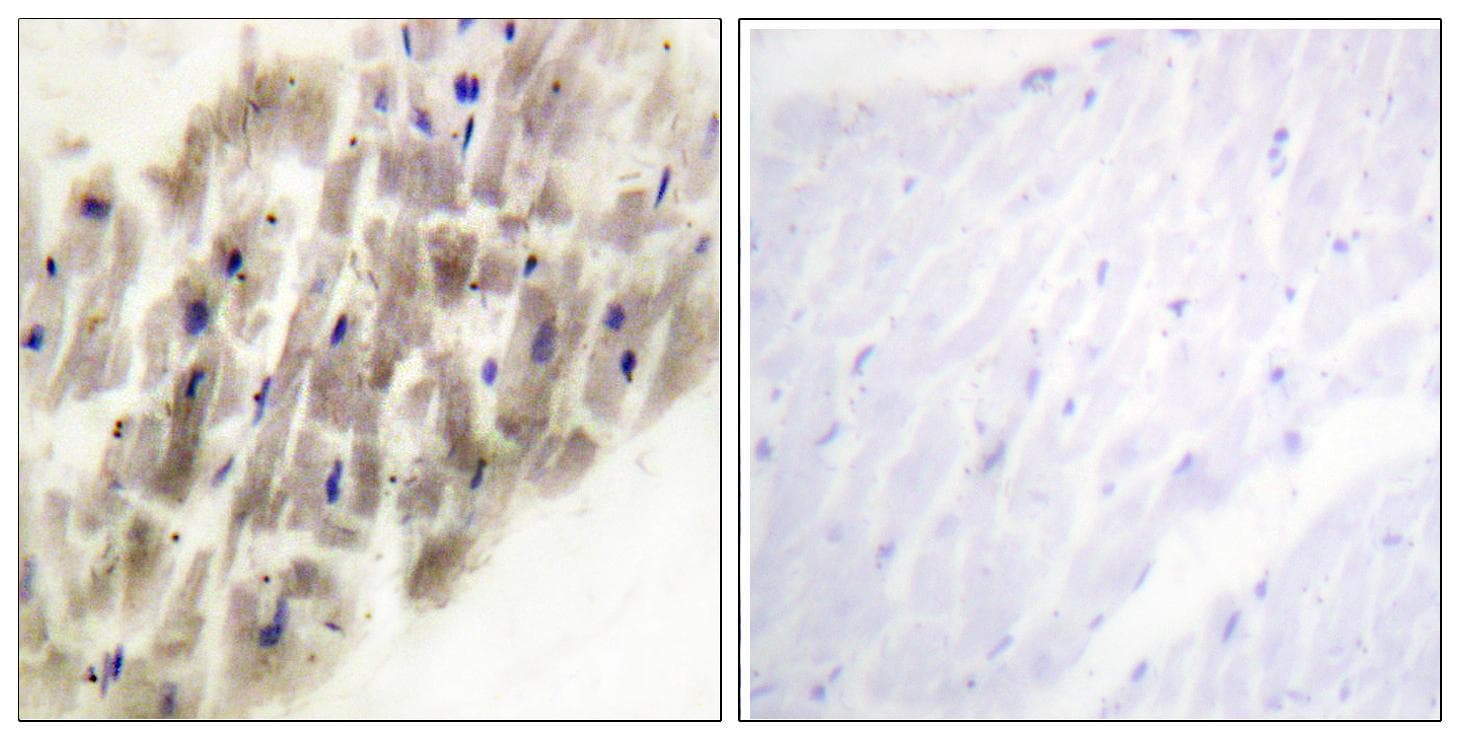 MAPKAPK2 / MAPKAP Kinase 2 Antibody (phospho-Thr222)