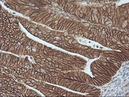 CTNNB1 / Beta Catenin Antibody (clone OTI9C1, Carrier-free)