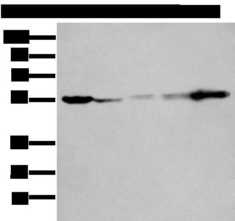 Polyclonal Rabbit anti-Human PFK2 / PFKFB3 Antibody (WB)