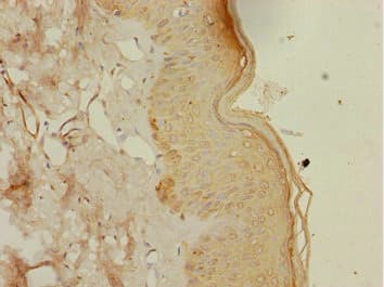 Polyclonal Rabbit anti-Human DTX2 Antibody (IHC)