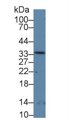 RPP40 / Ribonuclease P Antibody (aa91-259)