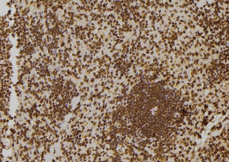 ZNF497 Antibody
