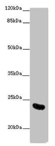 AICDA / AID Antibody