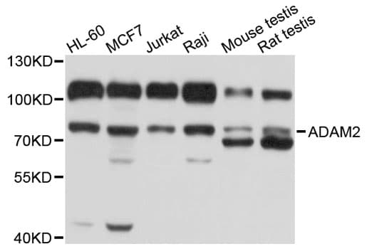 ADAM2 / Fertilin Beta Antibody