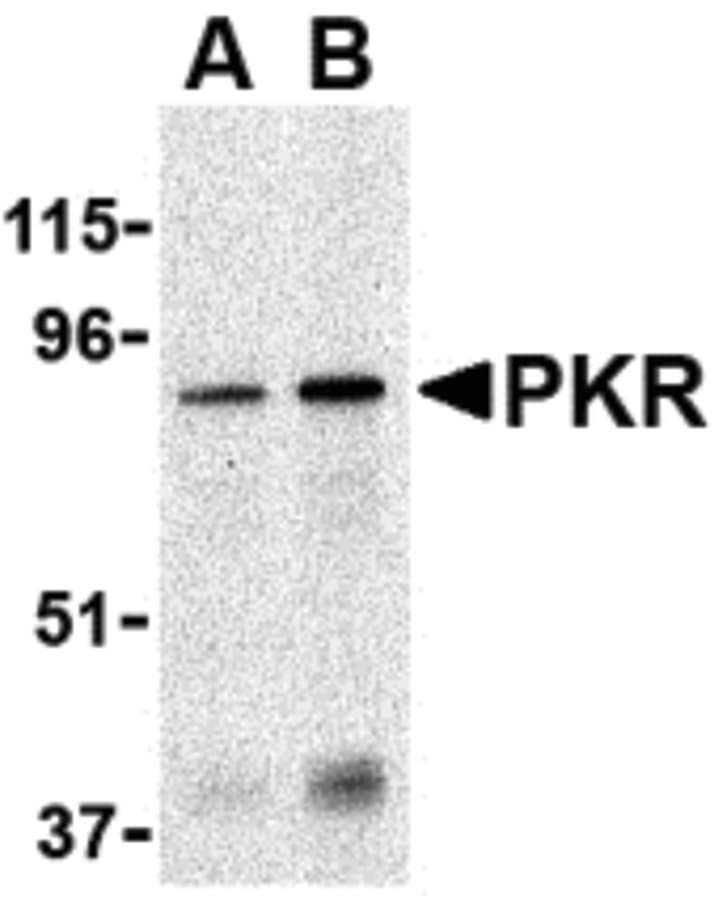 IHC-plus™ Polyclonal Rabbit anti-Human EIF2AK2 / PKR Antibody (IHC, WB)