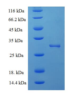 Human HN1 / ARM2 Protein (Recombinant His-SUMO)