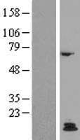 Human PTH / Parathyroid Hormone Protein (Over-Expression Lysate Myc-DDK (Flag))