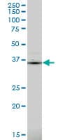 Monoclonal Mouse anti-Human PDLIM1 Antibody (clone 2D4, WB)