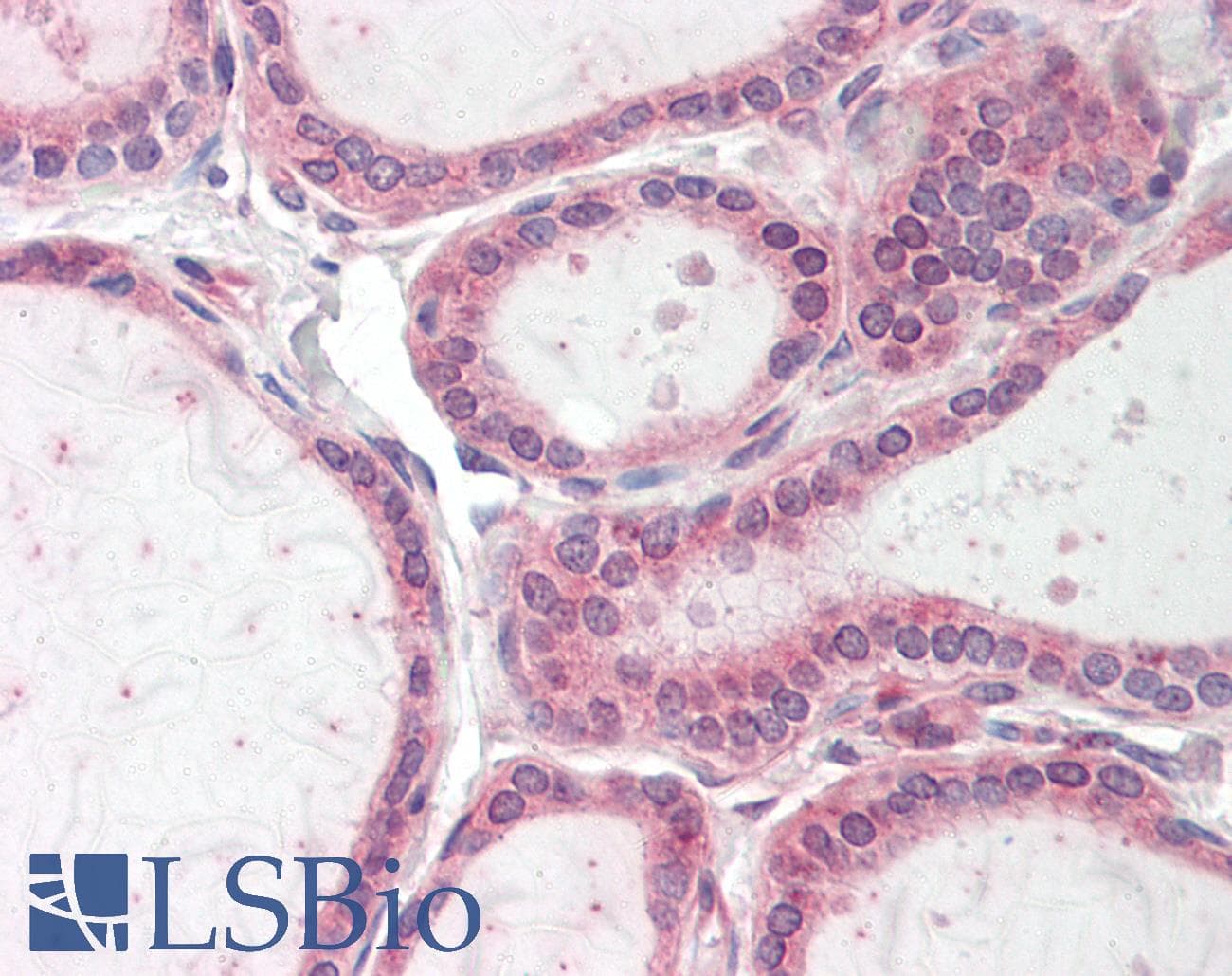 TBC1D4 / AS160 Antibody (aa1155-1204)