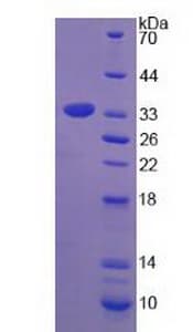 Rat Tpsb2 / Tryptase Beta 2 (Mouse Protein (Recombinant His)