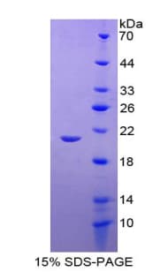 Human GPX1 / Glutathione Peroxidase Protein (Recombinant His-T7)