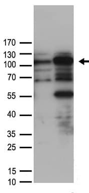SMARCA3 / HLTF Antibody
