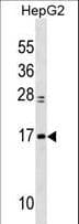 Polyclonal Rabbit anti-Human MYL6 Antibody (aa32-59, WB)