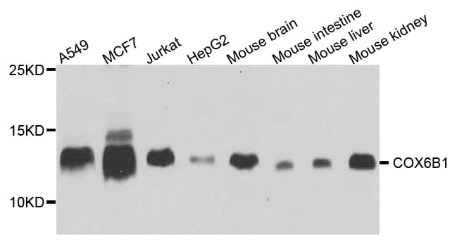 Polyclonal Rabbit anti-Human COXG / COX6B1 Antibody (IHC, WB)
