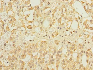 FILIP1L Antibody