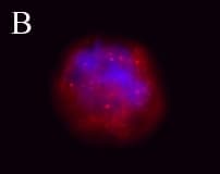 IHC-plus™ Tuberin / TSC2 Antibody (phospho-Ser664)