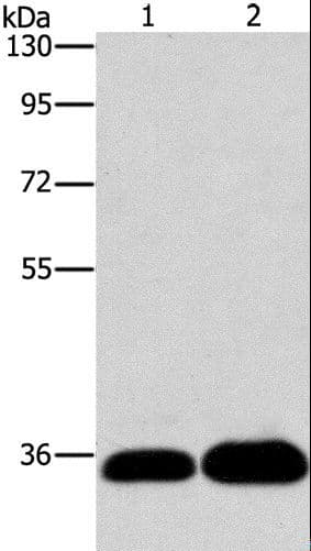 LIN28B Antibody