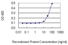 Monoclonal Mouse anti-Human KRT6B / CK6B / Cytokeratin 6B Antibody (clone 4G9, WB)