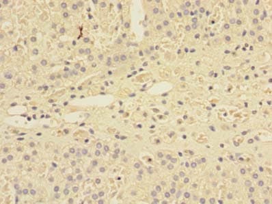 Polyclonal Rabbit anti-Human SHISA5 / SCOTIN Antibody (IHC)