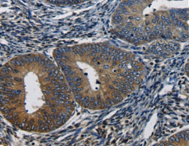 CTGF Antibody