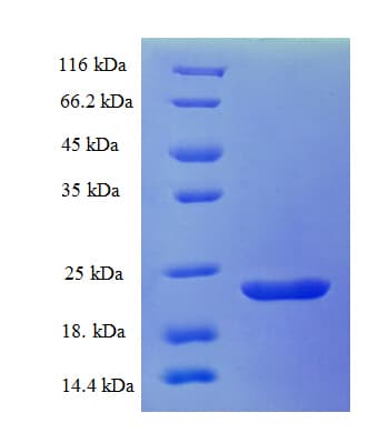 Echis carinatus Disintegrin EC3B Protein (Recombinant His-SUMO)