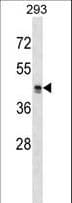 IHC-plus™ MRGPRX2 / MRGX2 Antibody (aa287-315)
