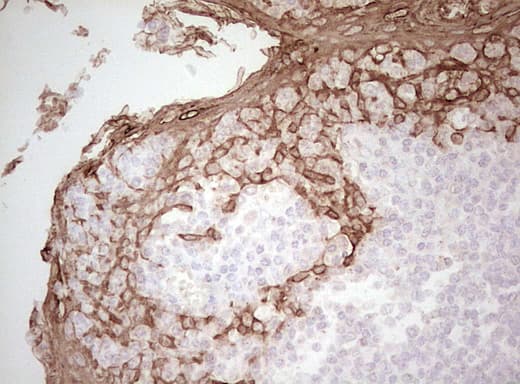 Basic Cytokeratin AE3 Antibody (clone AE3)