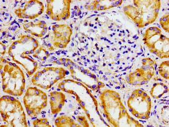 ADCY6 / Adenylate Cyclase 6 Antibody