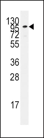 ADCY2 / Adenylate Cyclase 2 Antibody (aa940-969)