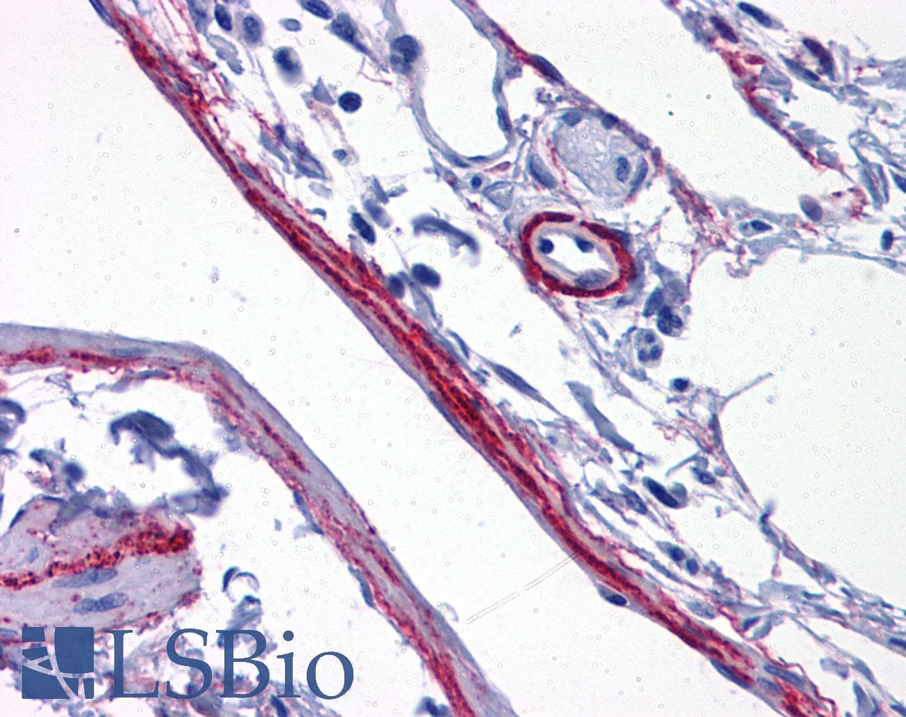 IHC-plus™ Polyclonal Rabbit anti-Human SYNPO / Synaptopodin Antibody (IHC, IF, WB)